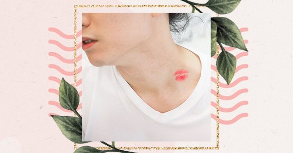 A Guide To Getting Rid Of A Hickey Quick a-guide-to-getting-rid-of-a-hickey-quick